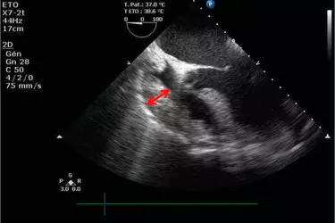 2d echo test in gurgaon
