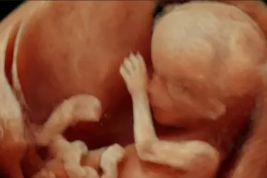 ultrasound in pregnancy