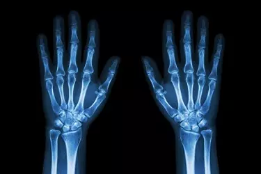 cost of digital xray